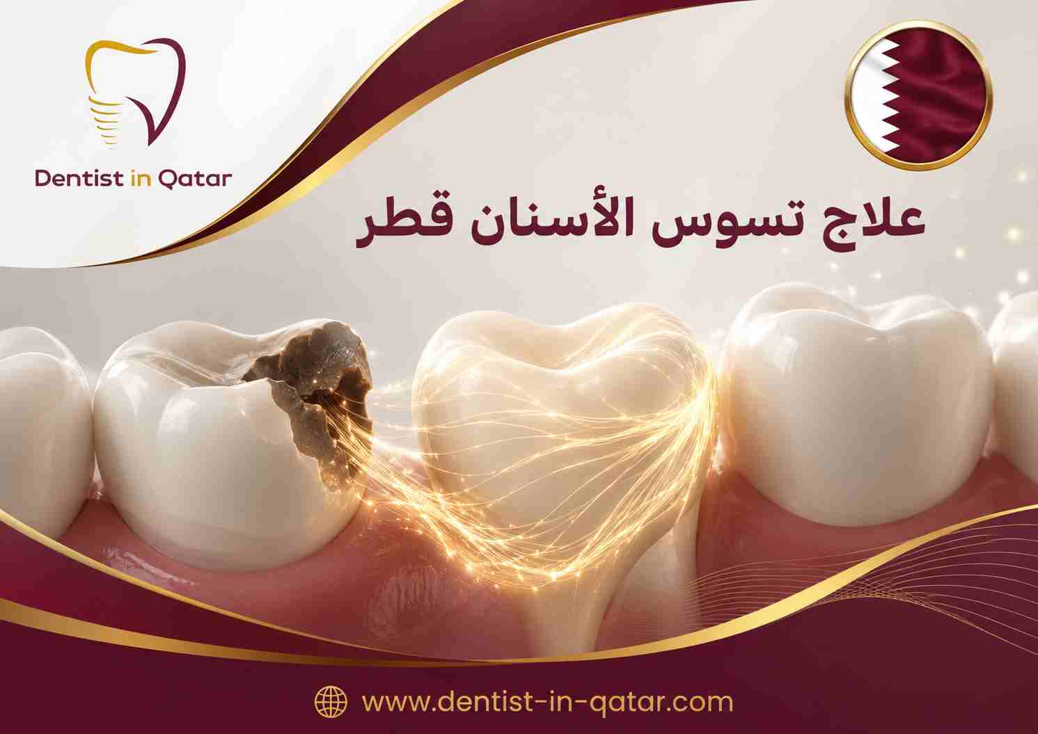 علاج تسوس الأسنان قطر