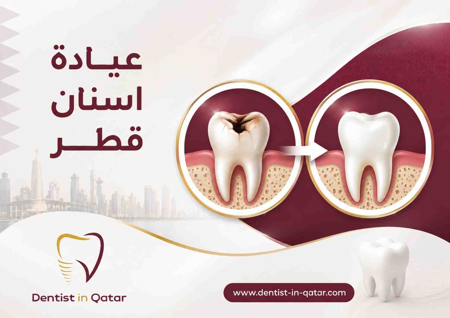 عيادة اسنان قطر