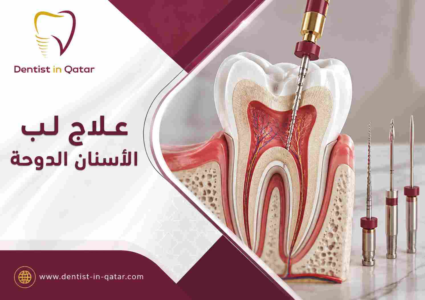 علاج لب الأسنان الدوحة علاج لب الأسنان الدوحة