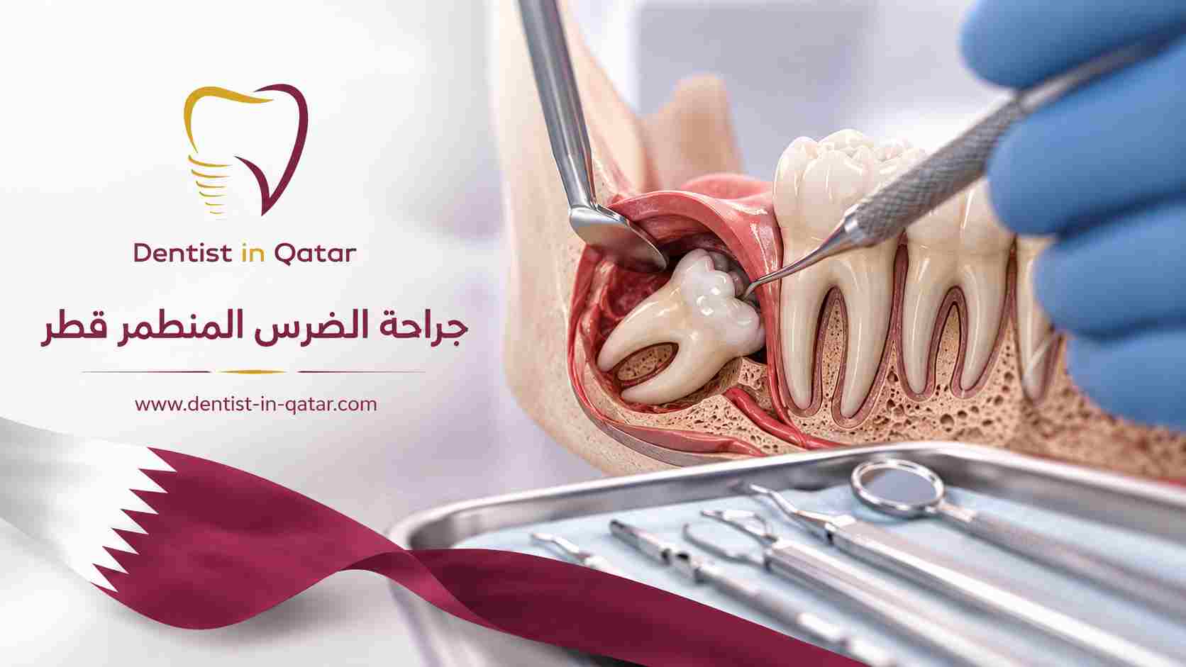 جراحة الضرس المنطمر قطر
